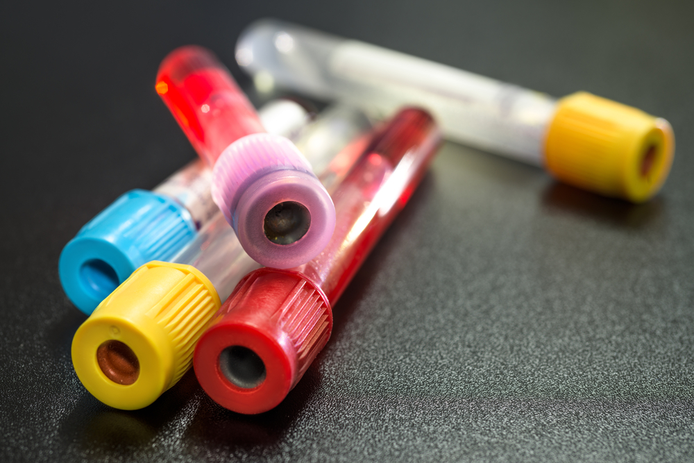 Vacuum blood collection tubes used in veterinary medical diagnostics lab testing
