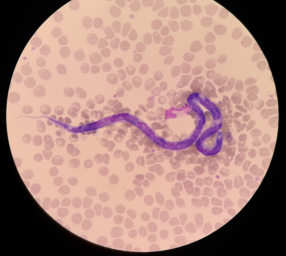 Microscopic blood smear slide showing microfilariae for veterinary heartworm diagnostics